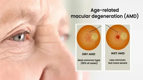 Age-related vision changes